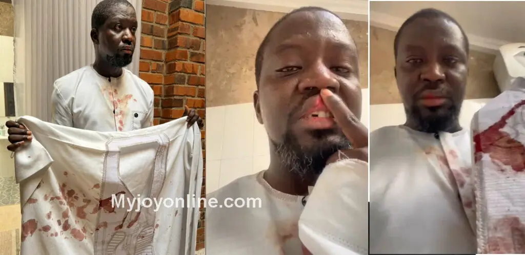 Ibrahim Mahama showing his blood-soaked dress, the cut on his lip and broken tooth