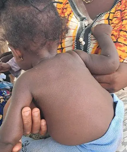 Heat Stress and Health Risks: Caring for Newborns in Tamale’s Rising Heat