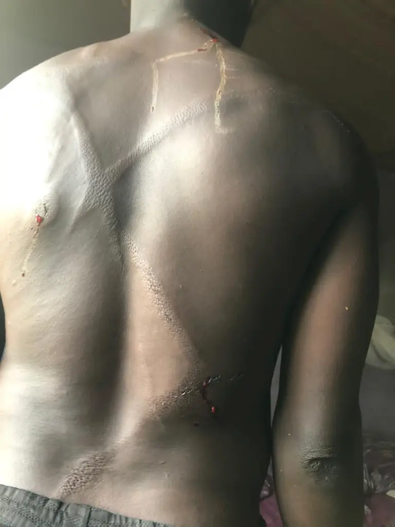 COHBS condemns alleged assault of headteacher, three teachers by 2BN battalions in Takoradi