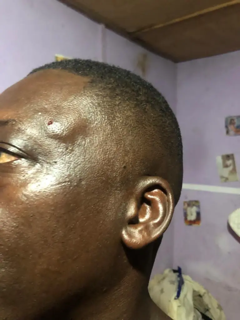 COHBS condemns alleged assault of headteacher, three teachers by 2BN battalions in Takoradi