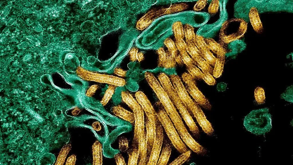New outbreak of Ebola kills 65 in eastern DR Congo