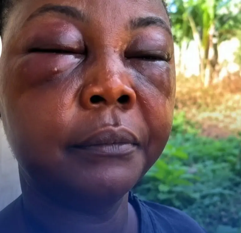 Jealous wife allegedly attacks husband’s side chick at Agona Nyakrom
