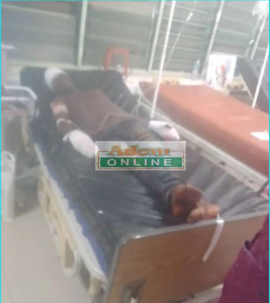 Woman hacks husband to death over charcoal money dispute at Ekumfi