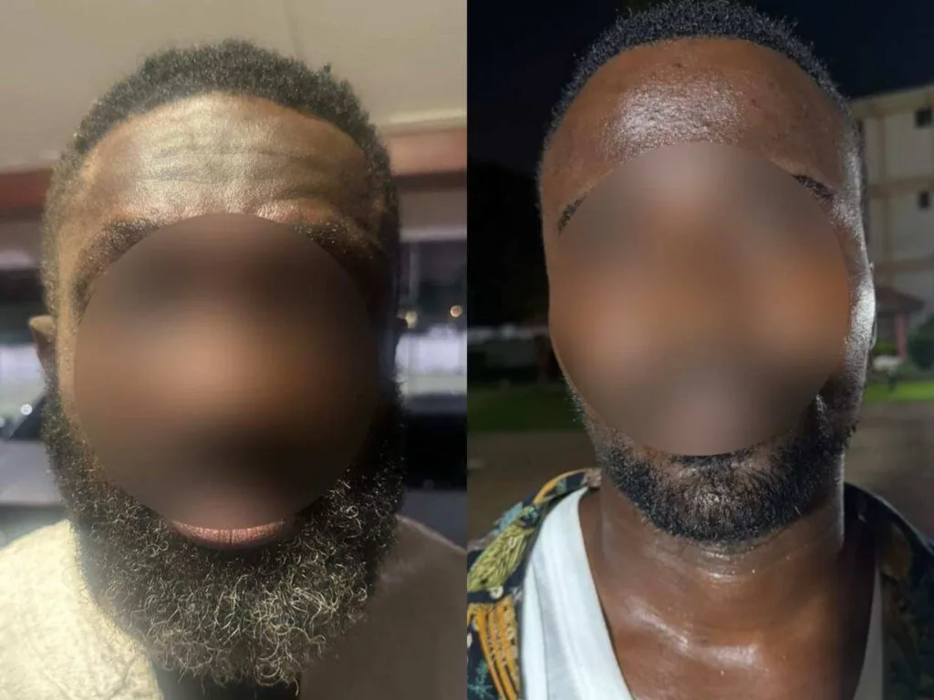 Police arrest alleged robbery syndicate linked to attacks across five cities