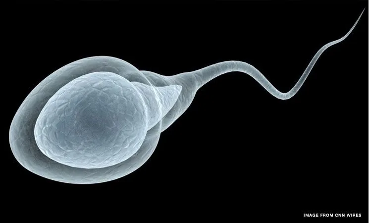 Men now “topping chart” in fertility issues as sperm quality declines – Urologist warns
