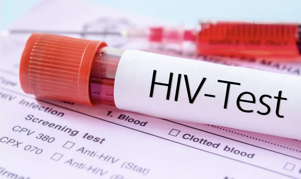 Over 1,000 persons acquire new HIV infections in Bono within five months – GAC