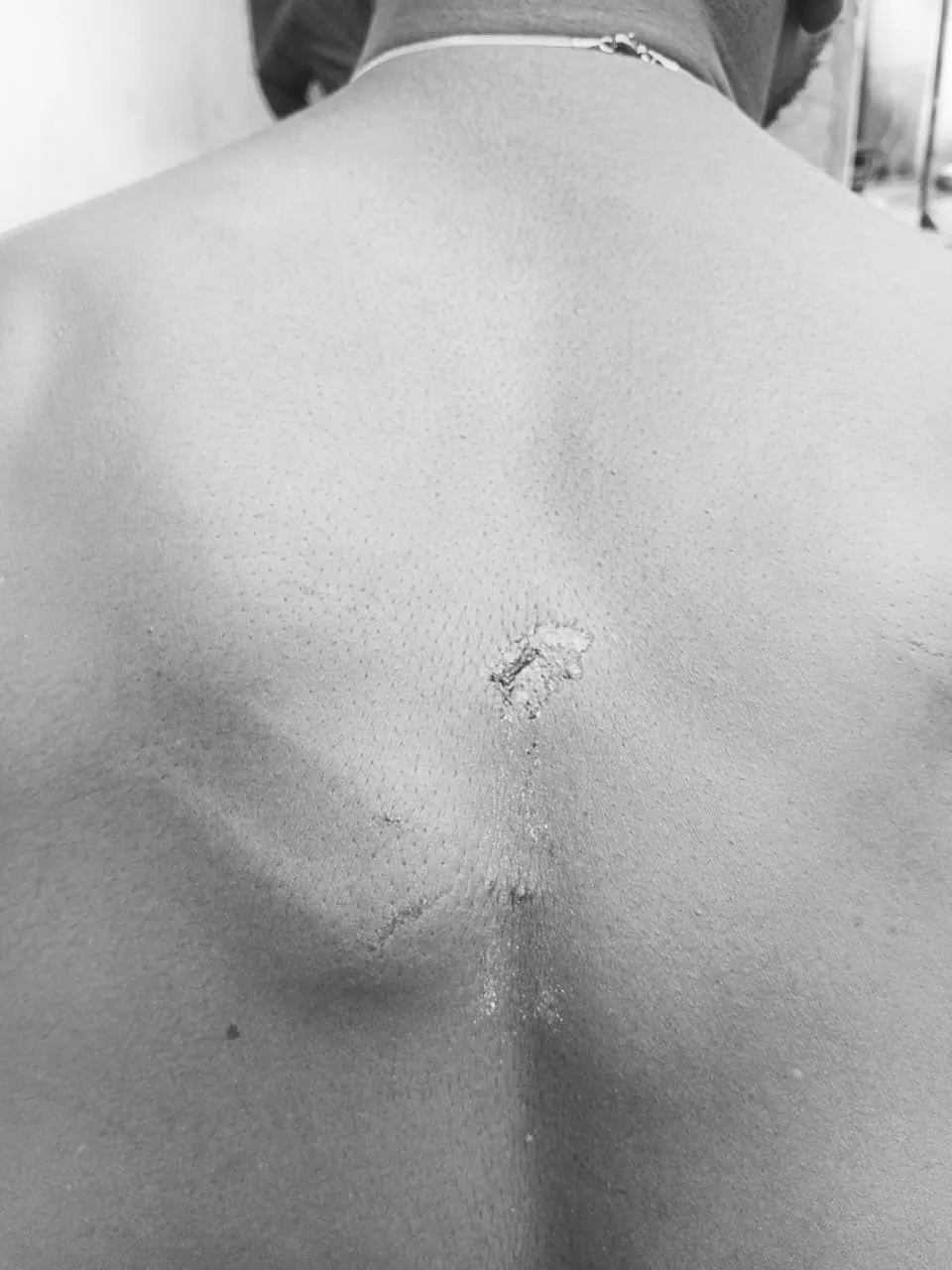 Eastern Region: 26-year-old allegedly assaulted by military personnel at Kyebi