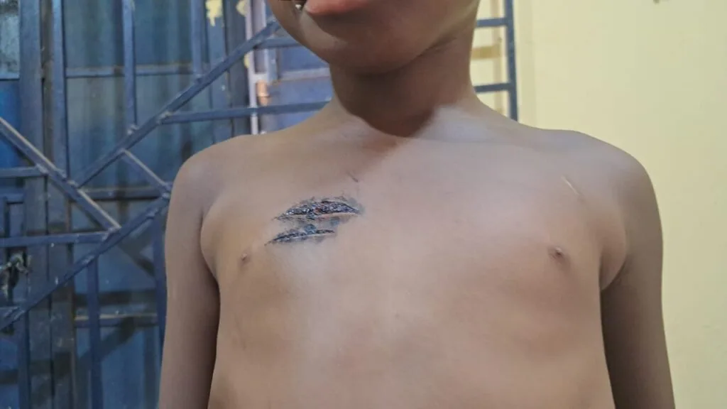 Nursing mother arrested for allegedly inflicting blade wounds on 5-year-old in Bole