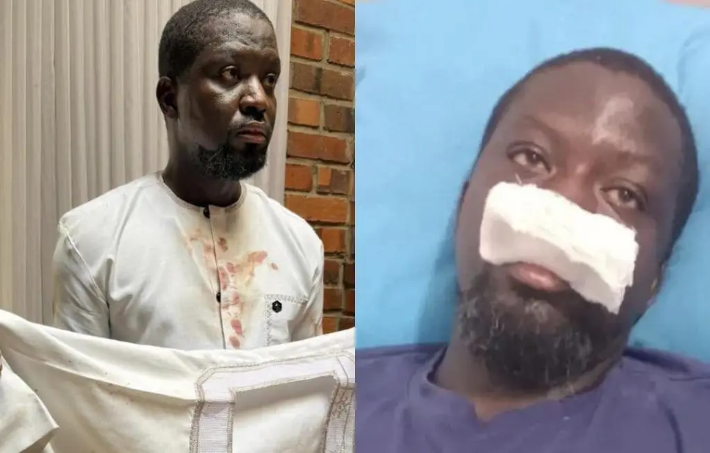 The Ibrahim Mahama brutality: Why Ghana needs independent police oversight