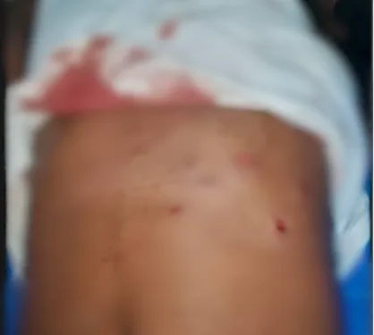 Two injured as armed robbers attack mobile money vendors in Central Region