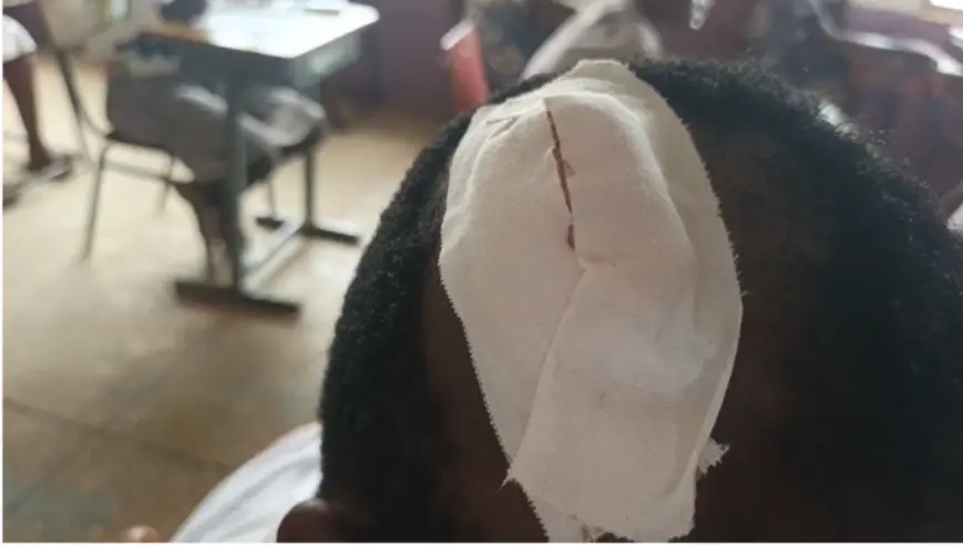 Two BECE candidates sit for exams despite motor accident in Nkwanta South