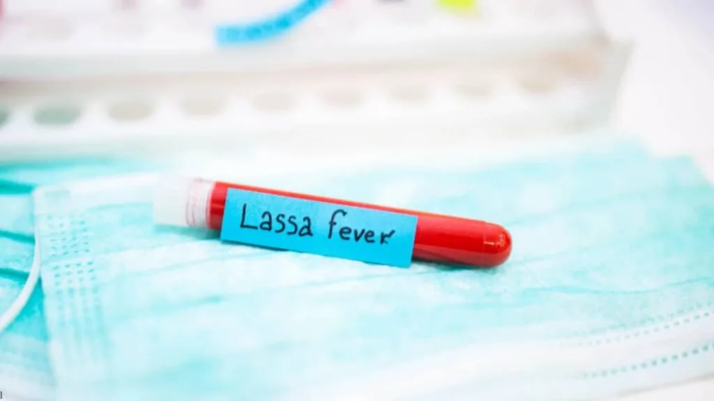 New study sets research priorities for future Lassa fever vaccine rollout in West Africa