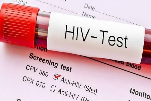 Ghana records decline in new HIV infections and AIDS deaths in 2025 – AIDS Commission report