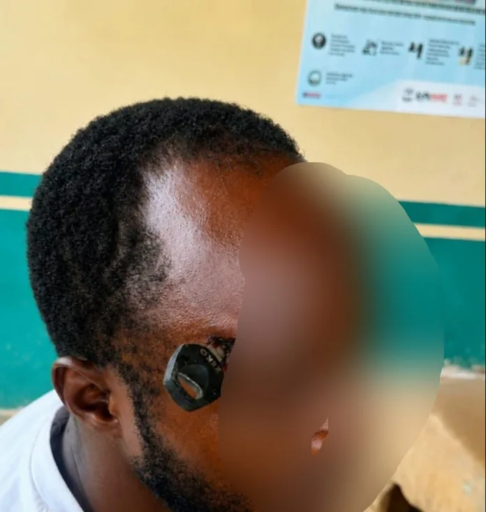 Okada rider allegedly drives motorbike key into man’s skull during fight over passenger