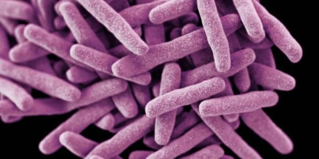KNUST scientists find dangerous drug-resistant TB strain in Ghana