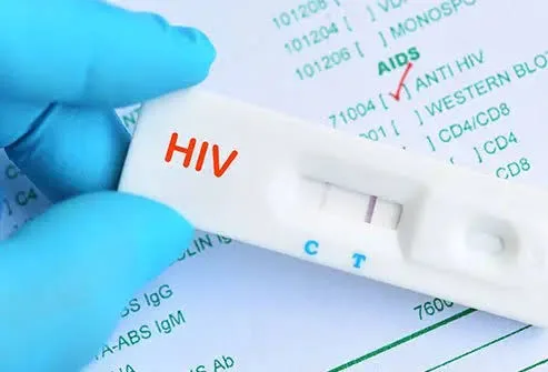 Ghana risks potential shortage of HIV testing kits by end of July