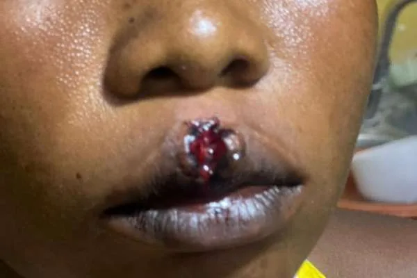Woman, 24, allegedly attacked during robbery attempt at Akatsi
