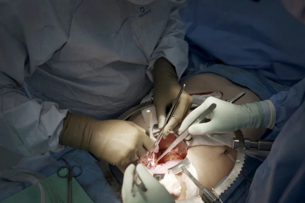 Nearly one in five Ghanaians may be living with chronic kidney disease as cases surge nationwide