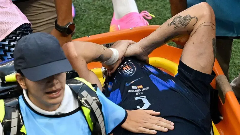 Ugarte has ‘most serious injury footballer can face’