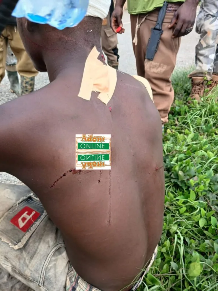 Suspected illegal loggers shoot forest guard at Abesewa