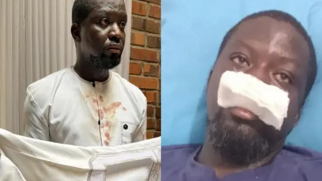 Ibrahim Mahama faces Police board as assault probe continues