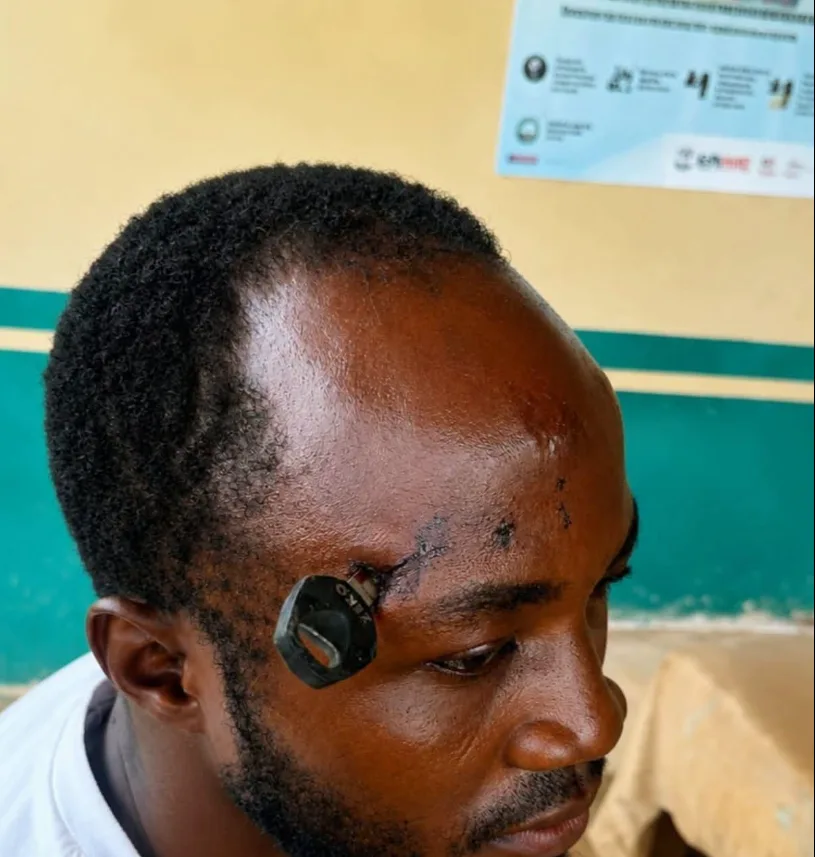 Okada rider allegedly drives motorbike key into man’s skull during fight over passenger