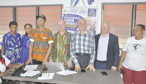 International Albinism Awareness Day marked in Ho