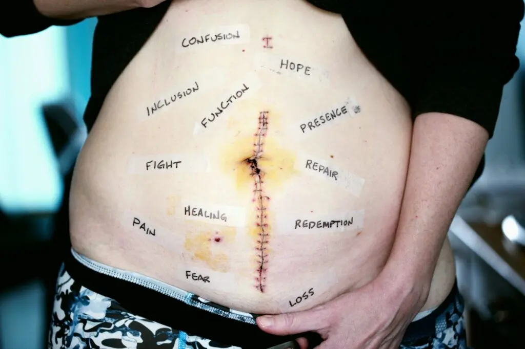 What everyone should know about C-sections