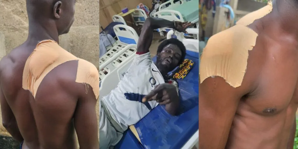 Mason remanded by Assin Fosu court over alleged robbery attack on farmer