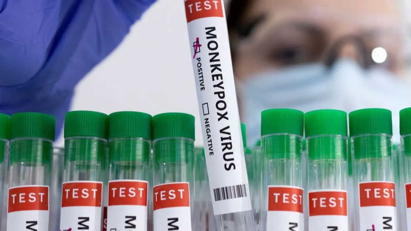Monkeypox is spreading among gay men worldwide