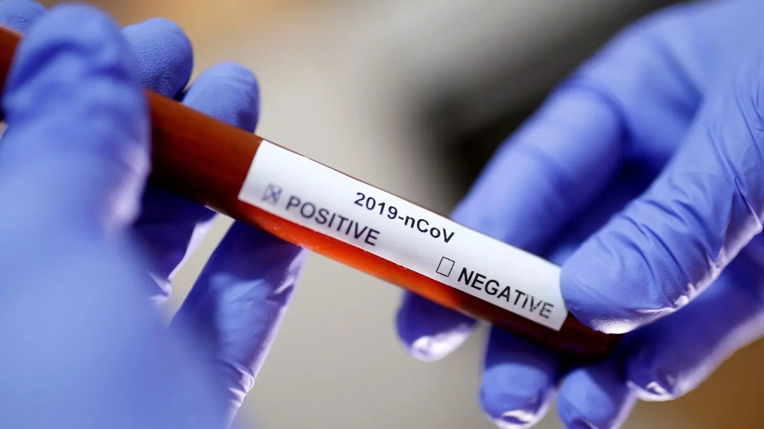 Ghana now has 834 COVID-19 cases — but these are not new cases
